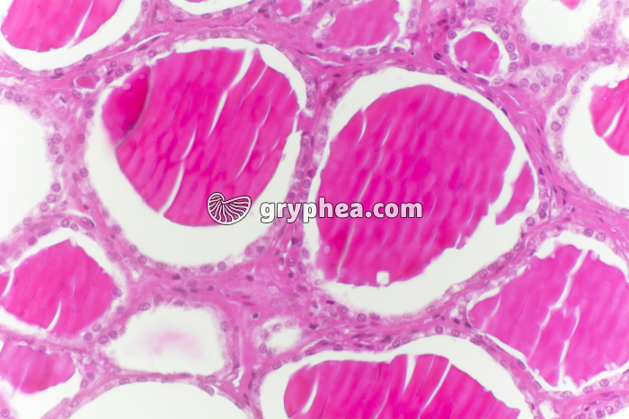 Thyroïde en hypo-activité x100 - gryphea.com